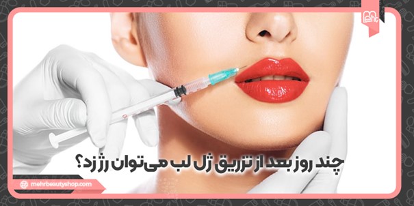 چند روز بعد از تزریق ژل لب می‌توان رژ زد؟