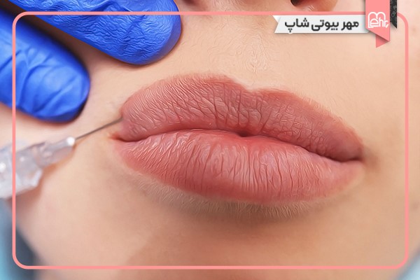 چرا نباید بلافاصله بعد از تزریق ژل رژ لب زد؟