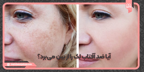 آیا ضد آفتاب لک را از بین می‌برد؟