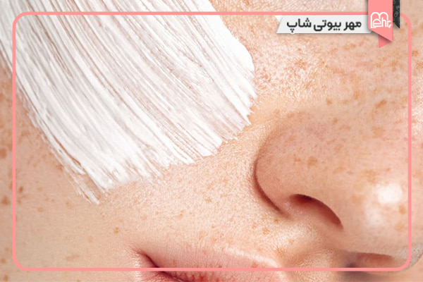 اهمیت کرم ضد آفتاب در پیشگیری و درمان لک