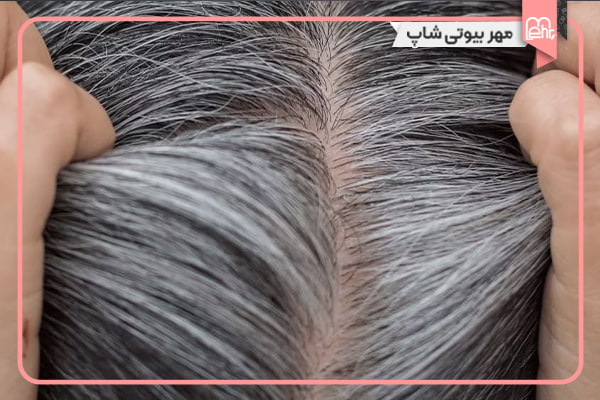 استفاده از روغن رزماری برای جلوگیری از سفیدی زودرس مو