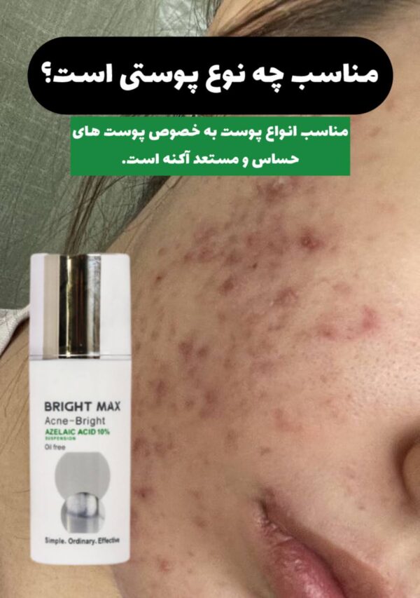 سوسپانسیون ضد آکنه و لک آزلائیک اسید برایت مکس - Image 6