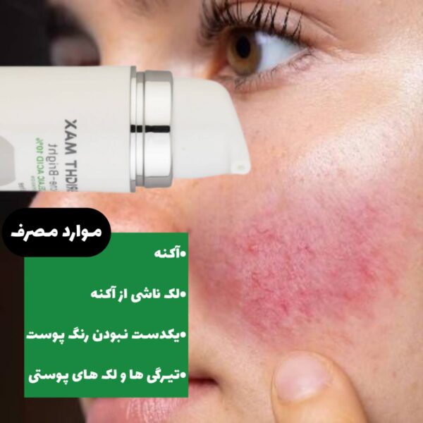 سوسپانسیون ضد آکنه و لک آزلائیک اسید برایت مکس - Image 7