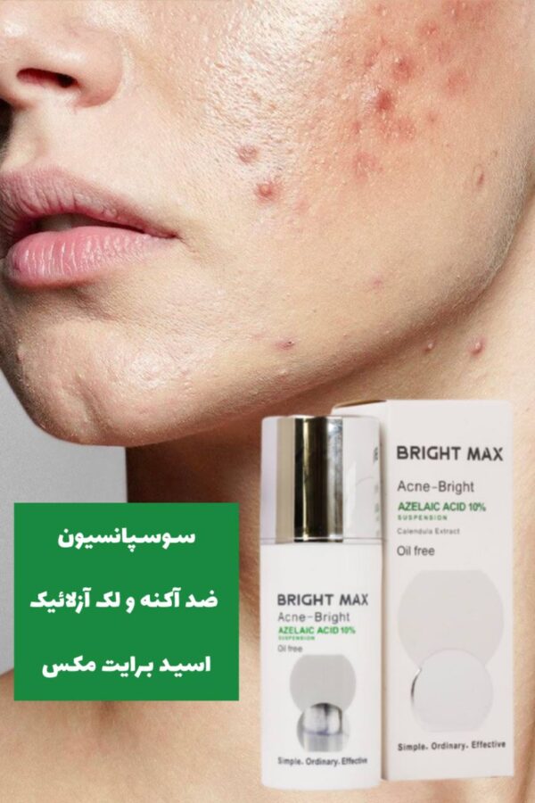 سوسپانسیون ضد آکنه و لک آزلائیک اسید برایت مکس - Image 2