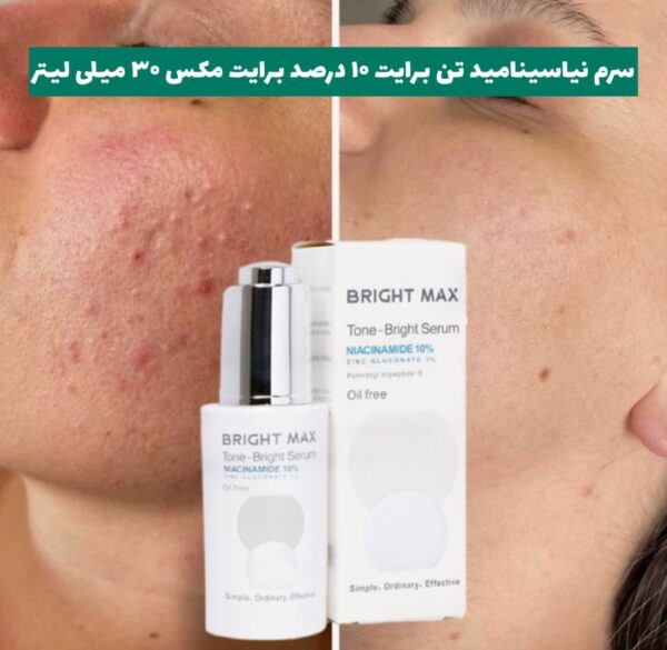 سرم نیاسینامید تن برایت ۱۰ درصد برایت مکس - Image 4