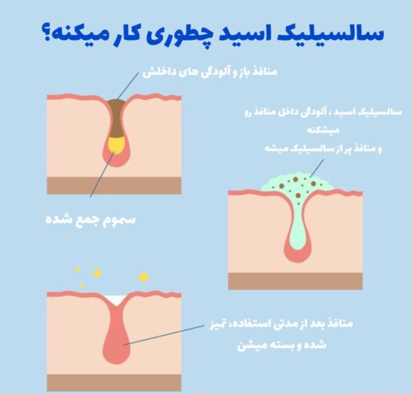 فوم شستشوی صورت آکنه برایت برایت مکس - Image 6