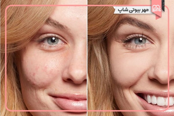 اهمیت انتخاب کرم پودر با پوشانندگی بالا