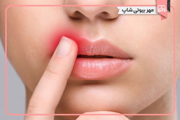 خطرات استفاده از تینت تقلبی برای پوست و لب