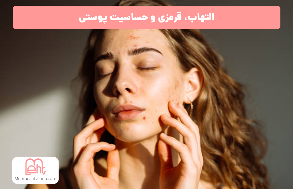 التهاب، قرمزی و حساسیت پوستی