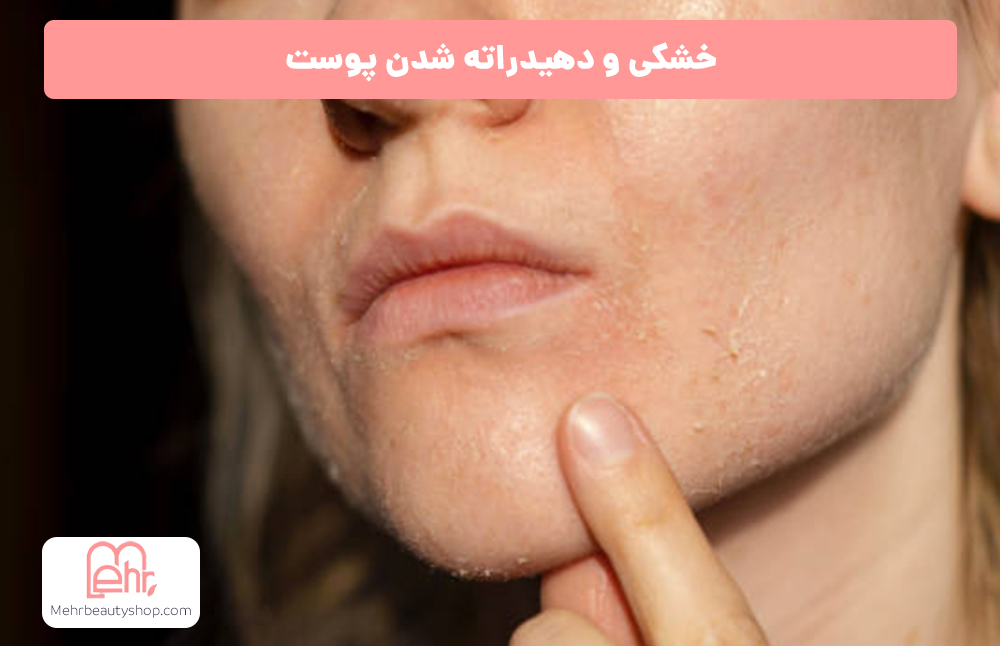 خشکی و دهیدراته شدن پوست