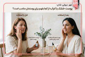 محصولات مناسب پوست خشک و کم آب